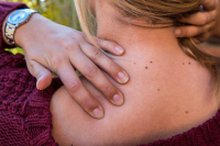 Rotator Manşet Yaralanmaları Nedir?